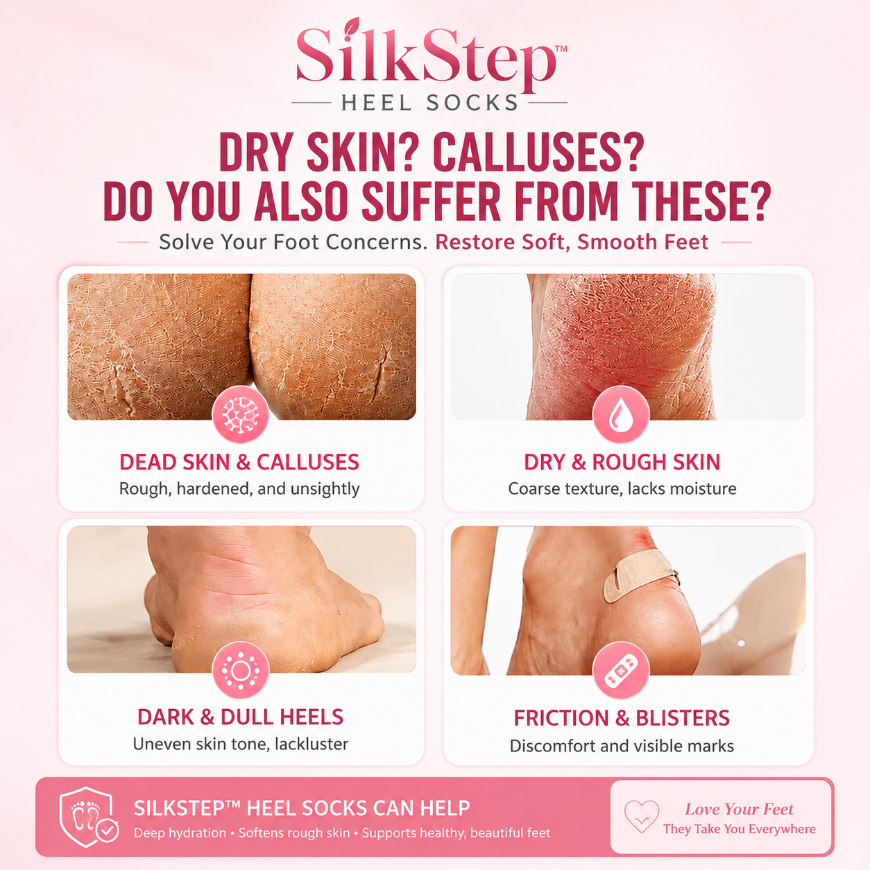 SilkStep™ Heel Socks